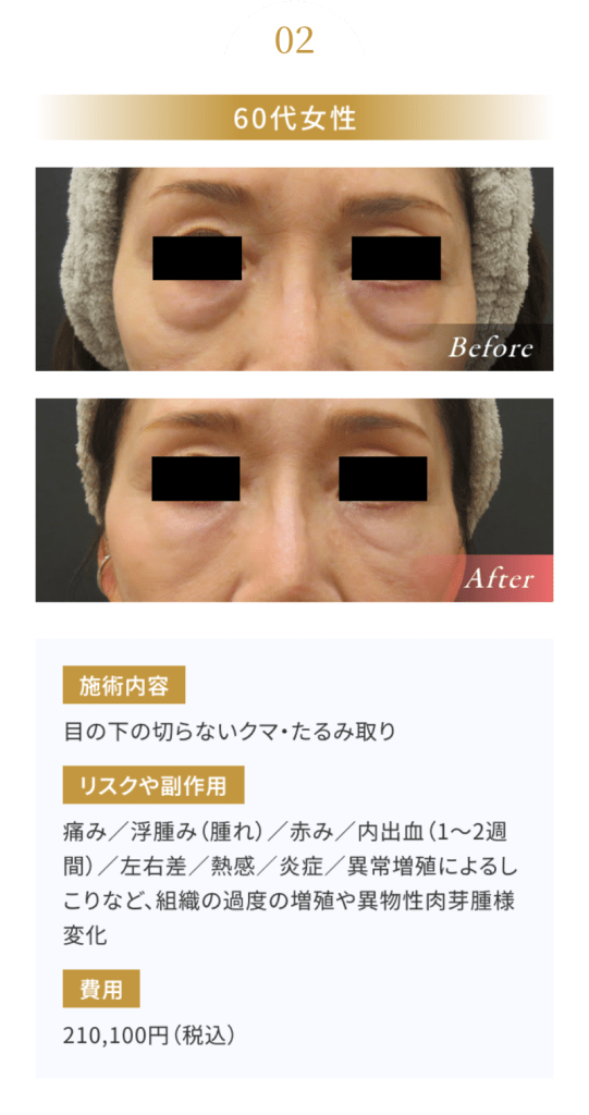 グループ 218