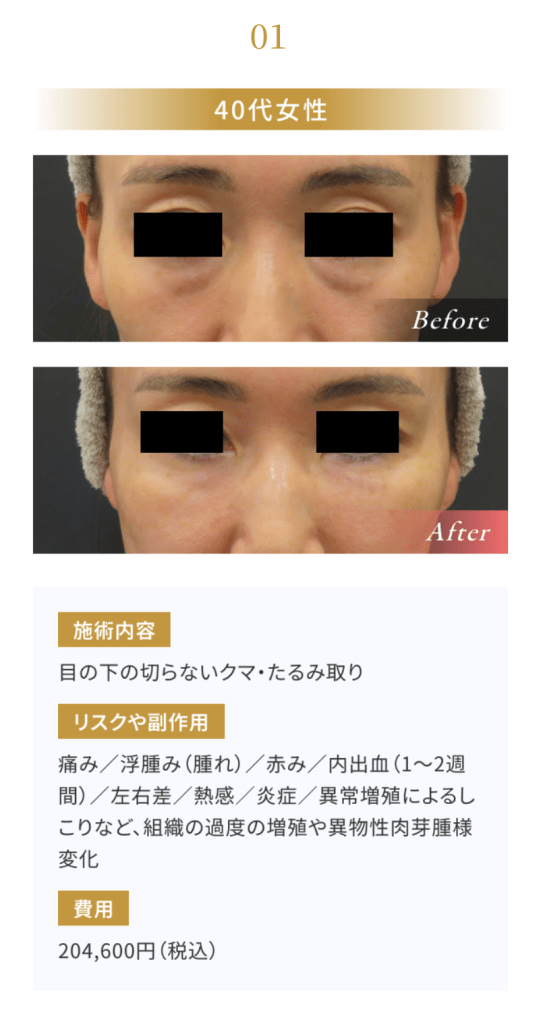 グループ 219